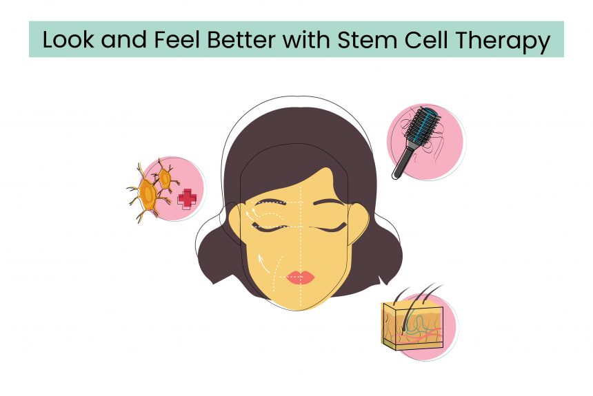 Look and Feel Better with Stem Cell Therapy