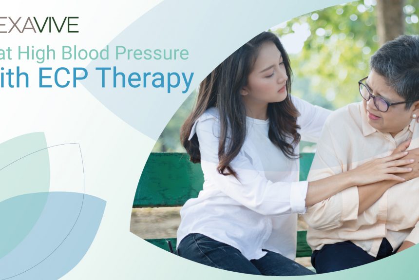Beat High Blood Pressure With ECP Therapy