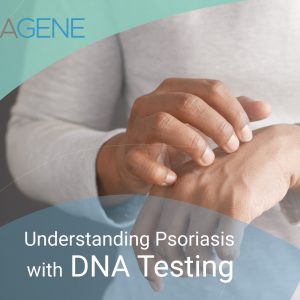 Understanding Psoriasis with DNA Testing
